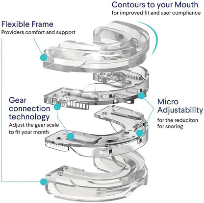 SleepGuard Pro: Advanced Bruxism & Snoring Stopper